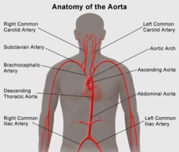 The aorta with its different main branches