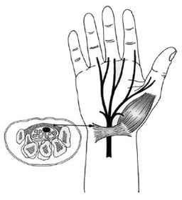 carpal (wrist) tunnel