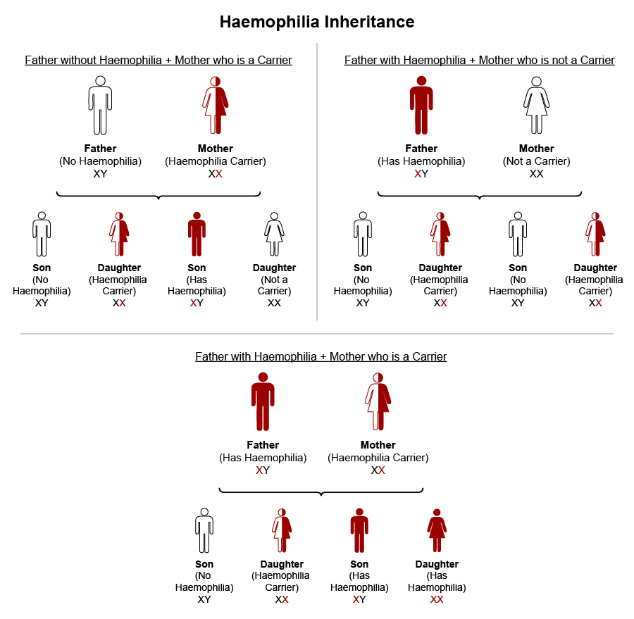 Haemophilia Inheritance