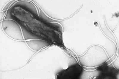 Helicobacter Pylori infection