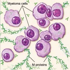 Myeloma cells